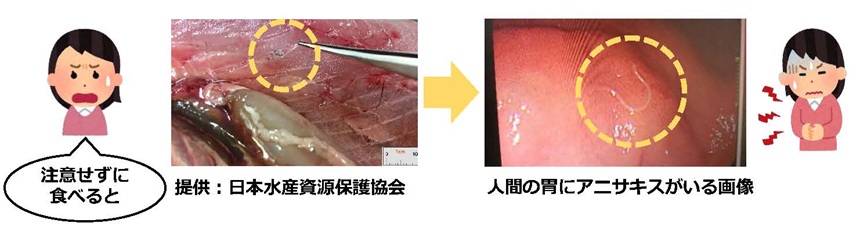 アニサキスがいる画像