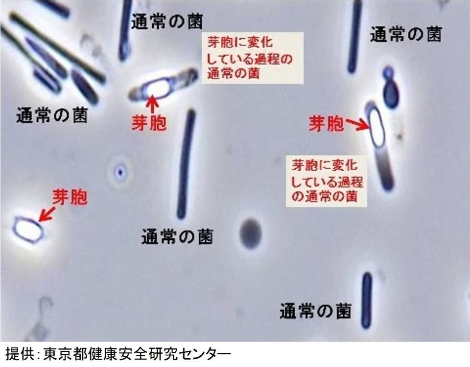 ウェルシュ菌（通常の菌と芽胞）