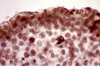 図6　粉状そうか病にり病したばれいしょのこぶ中の胞子球