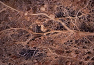 図7　粉状そうか病にり病したばれいしょ根のこぶ